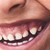 CANINES